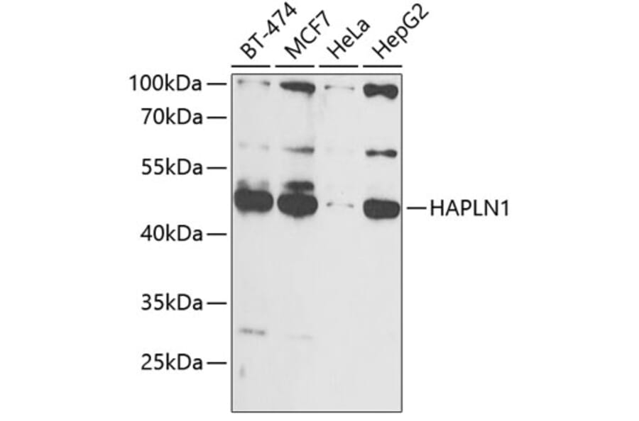 Western Blot - Anti-HAPLN1 Antibody (A90121) - Antibodies.com