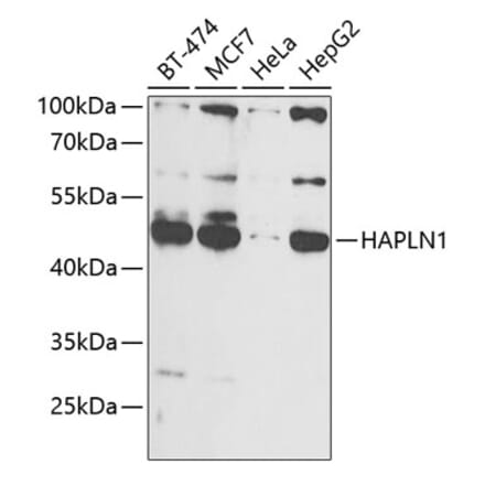 Western Blot - Anti-HAPLN1 Antibody (A90121) - Antibodies.com