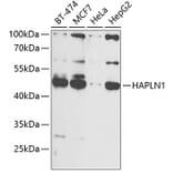 Western Blot - Anti-HAPLN1 Antibody (A90121) - Antibodies.com
