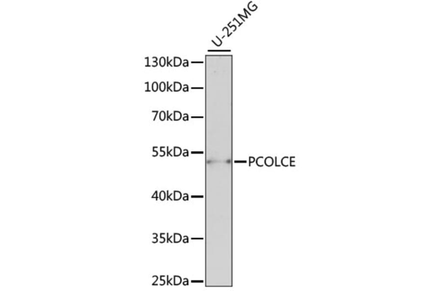 Western Blot - Anti-PCOLCE Antibody (A90122) - Antibodies.com