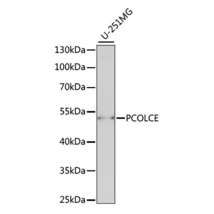 Western Blot - Anti-PCOLCE Antibody (A90122) - Antibodies.com