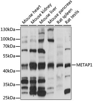 Western blot analysis of extracts of various cell lines, using Anti-METAP1 Antibody (A15796) at 1:1,000 dilution.
Secondary antibody: Goat Anti-Rabbit IgG (H+L) (HRP) (AS014) at 1:10,000 dilution.
Lysates / proteins: 25µg per lane.
Blocking buffer: 3% non-fat dry milk in TBST.
Detection: ECL Basic Kit (RM00020).
Exposure time: 1s.