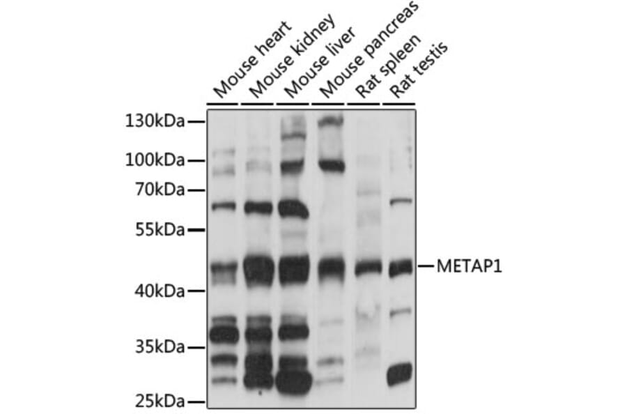 Western Blot - Anti-Methionyl Aminopeptidase 1/MAP 1 Antibody (A90123) - Antibodies.com