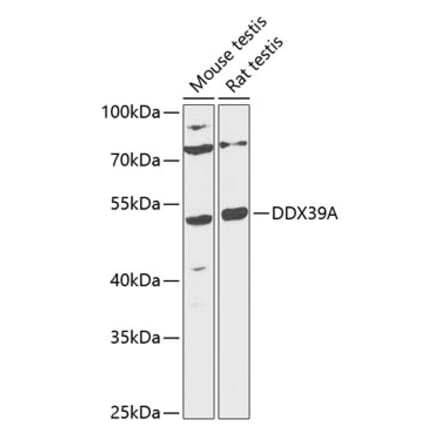 Western Blot - Anti-DDX39 Antibody (A90124) - Antibodies.com