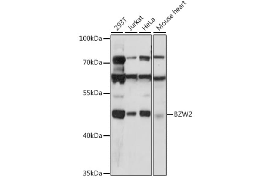 Western Blot - Anti-BZW2 Antibody (A90125) - Antibodies.com