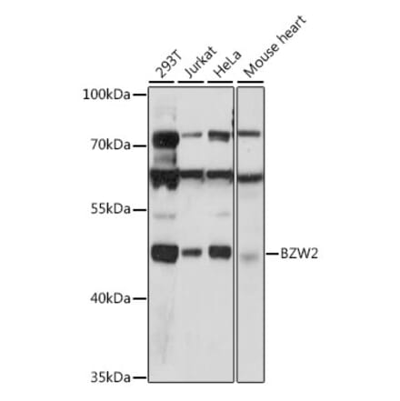 Western Blot - Anti-BZW2 Antibody (A90125) - Antibodies.com