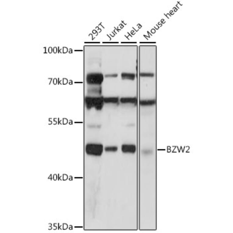 Western Blot - Anti-BZW2 Antibody (A90125) - Antibodies.com