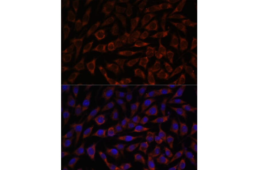 Immunofluorescence - Anti-BZW2 Antibody (A90125) - Antibodies.com