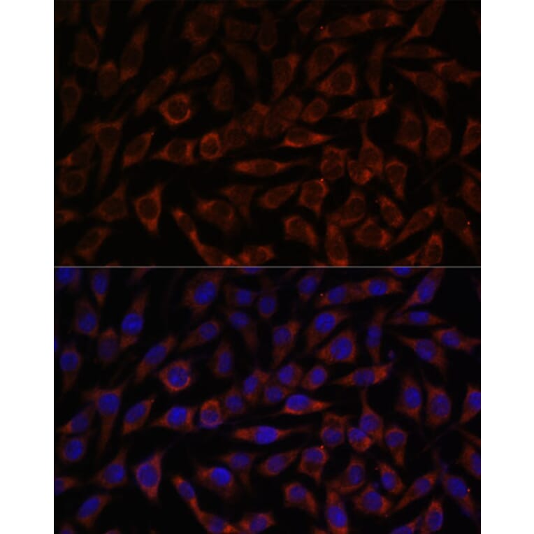 Immunofluorescence - Anti-BZW2 Antibody (A90125) - Antibodies.com