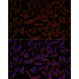 Immunofluorescence - Anti-BZW2 Antibody (A90125) - Antibodies.com