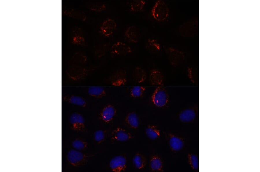 Immunofluorescence - Anti-BZW2 Antibody (A90125) - Antibodies.com