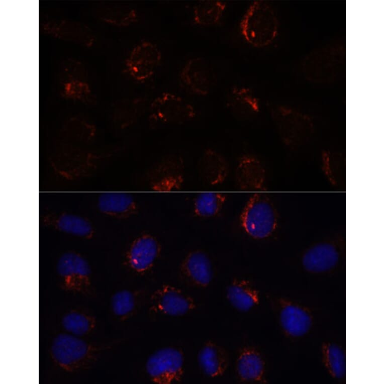 Immunofluorescence - Anti-BZW2 Antibody (A90125) - Antibodies.com