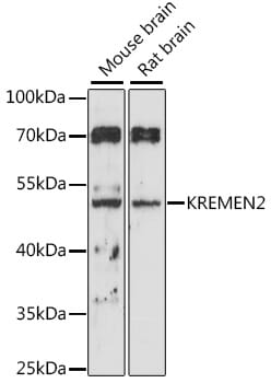 Western blot analysis of extracts of various cell lines, using Anti-KREMEN2 Antibody (A16202) at 1:1,000 dilution.
Secondary antibody: Goat Anti-Rabbit IgG (H+L) (HRP) (AS014) at 1:10,000 dilution.
Lysates / proteins: 25µg per lane.
Blocking buffer: 3% non-fat dry milk in TBST.
Detection: ECL Basic Kit (RM00020).
Exposure time: 120s.