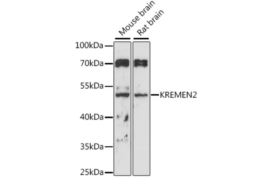 Western Blot - Anti-KREMEN2 Antibody (A90126) - Antibodies.com