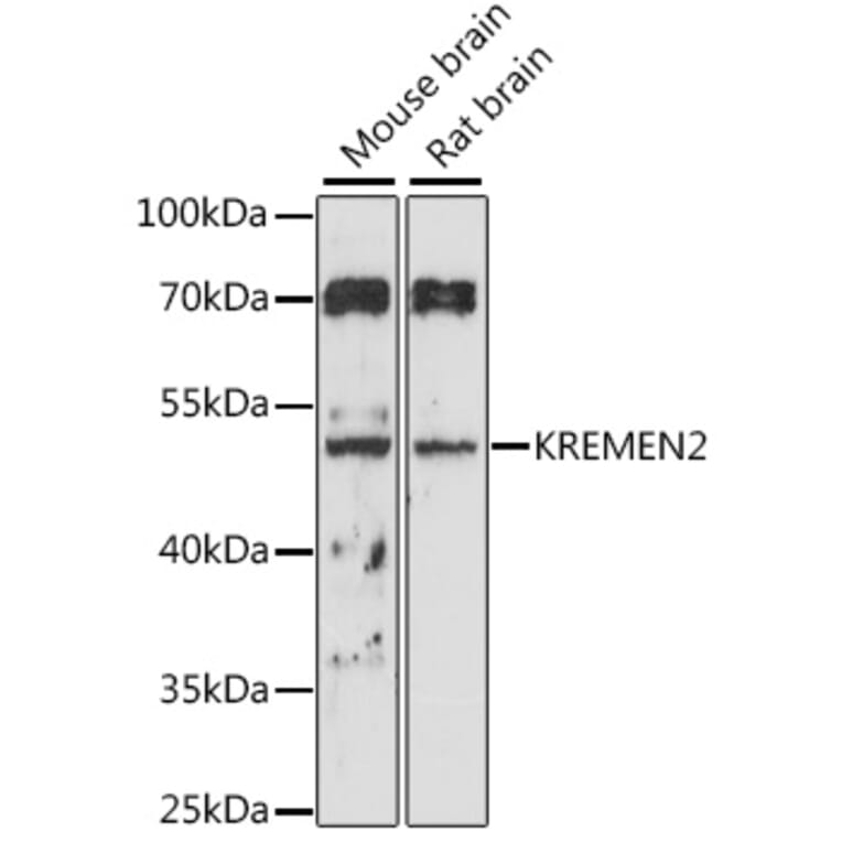Western Blot - Anti-KREMEN2 Antibody (A90126) - Antibodies.com