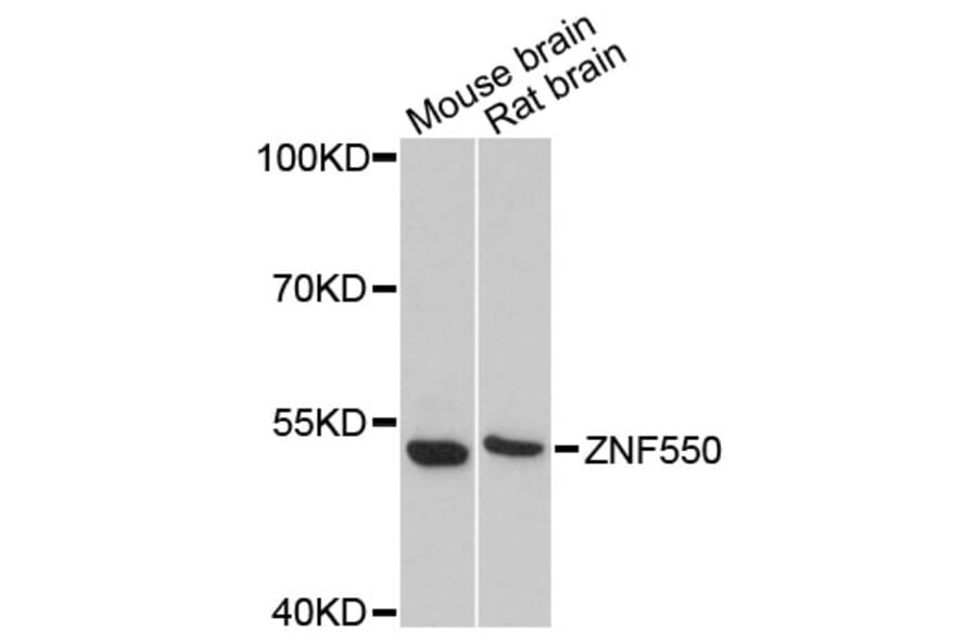 Western Blot - Anti-ZNF550 Antibody (A13750) - Antibodies.com