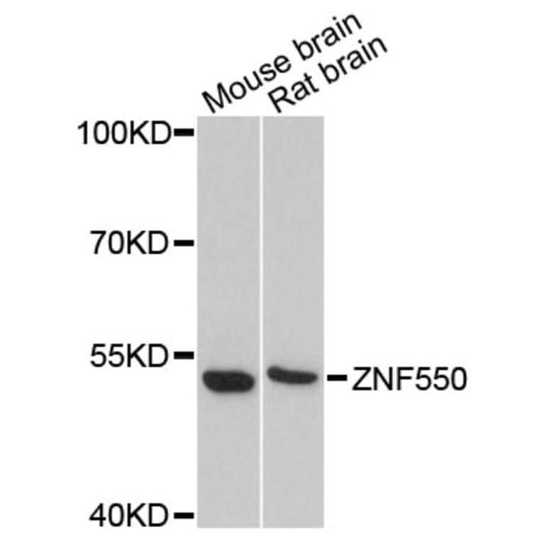 Western Blot - Anti-ZNF550 Antibody (A13750) - Antibodies.com
