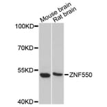 Western Blot - Anti-ZNF550 Antibody (A13750) - Antibodies.com