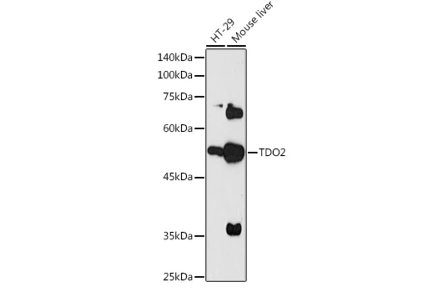 Western Blot - Anti-TDO2/TDO Antibody (A90128) - Antibodies.com