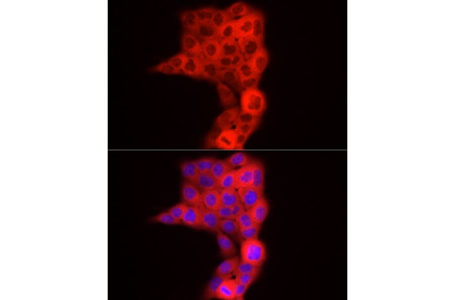 Immunofluorescence - Anti-TDO2/TDO Antibody (A90128) - Antibodies.com