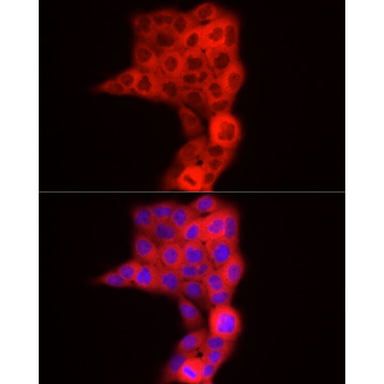 Immunofluorescence - Anti-TDO2/TDO Antibody (A90128) - Antibodies.com