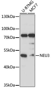 Western blot analysis of extracts of various cells, using Anti-NEU3 Antibody (A13842) at 1:3000 dilution.
Secondary antibody: Goat Anti-Rabbit IgG (H+L) (HRP) (AS014) at 1:10,000 dilution.
Lysates / proteins: 25µg per lane.
Blocking buffer: 3% non-fat dry milk in TBST.
Detection: ECL Basic Kit (RM00020).
Exposure time: 30s.