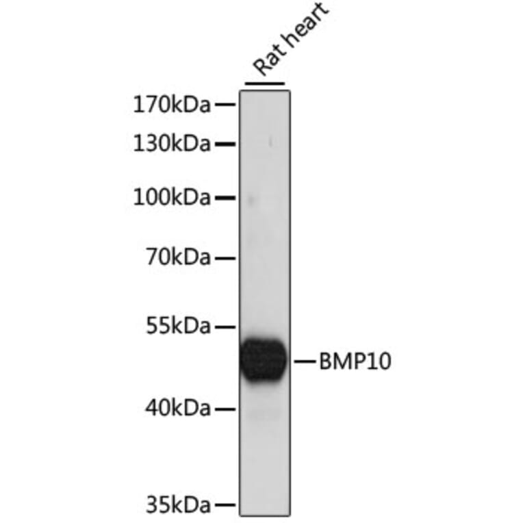 Western Blot - Anti-BMP10 Antibody (A90130) - Antibodies.com
