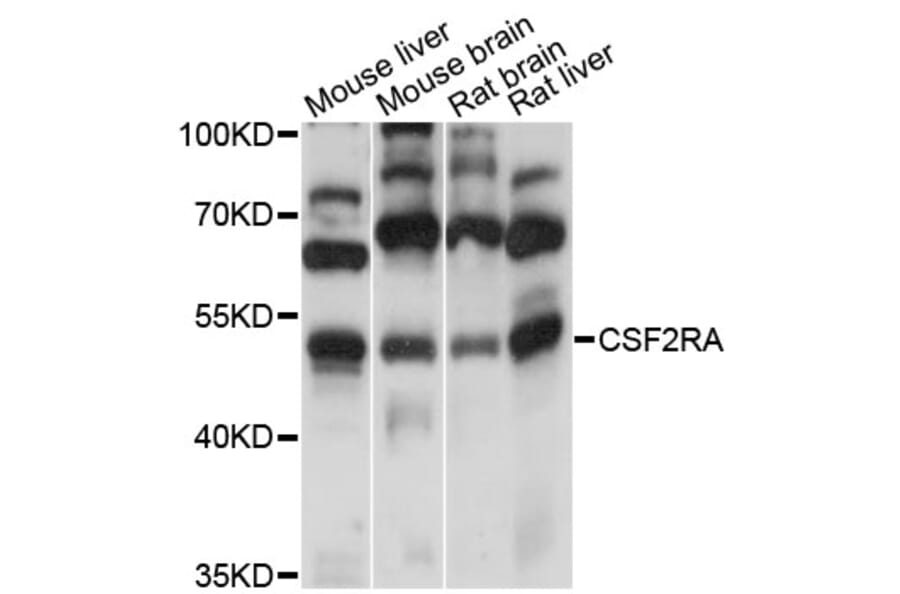 Western Blot - Anti-CSF2RA Antibody (A13181) - Antibodies.com