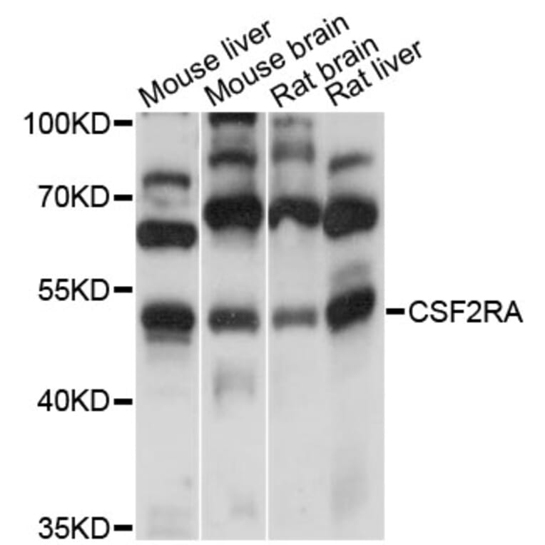 Western Blot - Anti-CSF2RA Antibody (A13181) - Antibodies.com