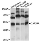 Western Blot - Anti-CSF2RA Antibody (A13181) - Antibodies.com