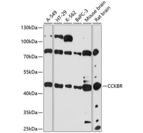 Western Blot - Anti-CCK2-R Antibody (A90132) - Antibodies.com