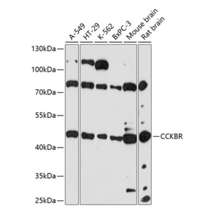 Western Blot - Anti-CCK2-R Antibody (A90132) - Antibodies.com