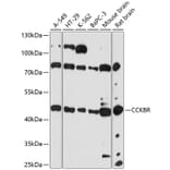 Western Blot - Anti-CCK2-R Antibody (A90132) - Antibodies.com