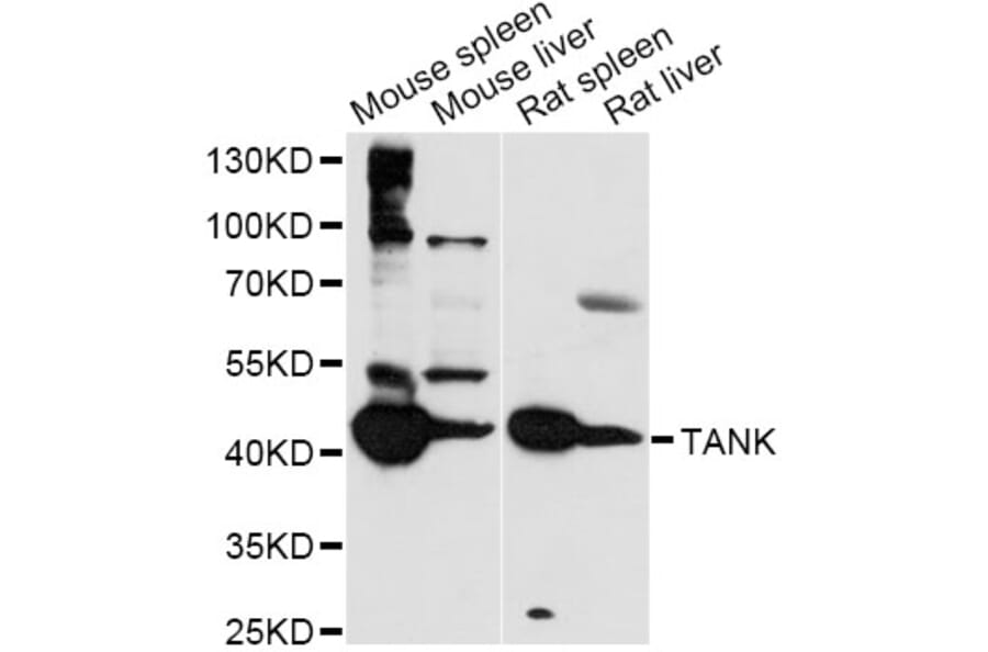 Western Blot - Anti-TANK Antibody (A14501) - Antibodies.com