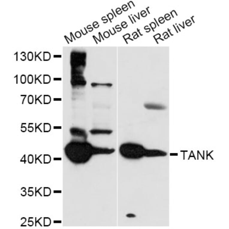 Western Blot - Anti-TANK Antibody (A14501) - Antibodies.com