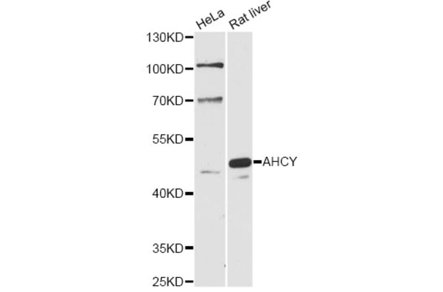 Western Blot - Anti-AHCY Antibody (A14182) - Antibodies.com