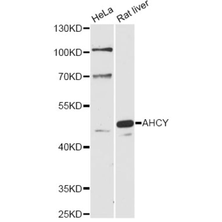 Western Blot - Anti-AHCY Antibody (A14182) - Antibodies.com