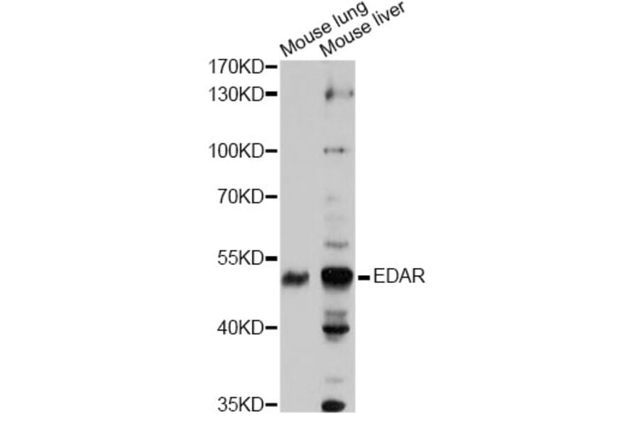 Western Blot - Anti-EDAR Antibody (A14105) - Antibodies.com