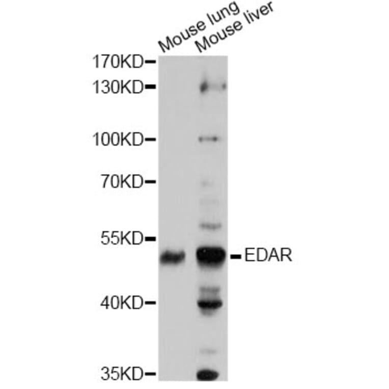 Western Blot - Anti-EDAR Antibody (A14105) - Antibodies.com