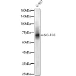 Western Blot - Anti-SIGLEC6 Antibody (A90137) - Antibodies.com