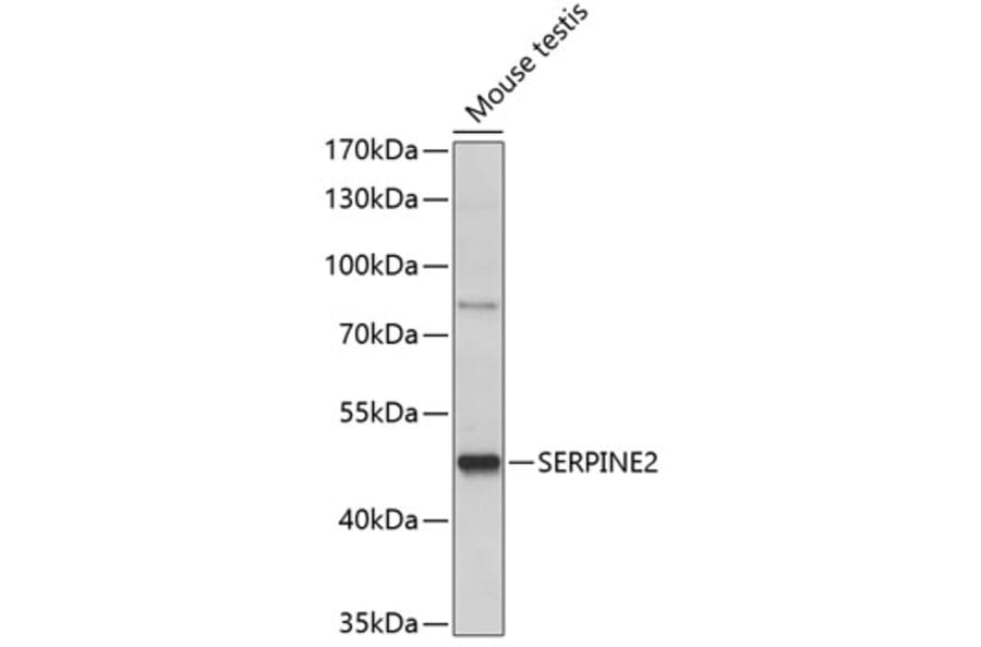Western Blot - Anti-SERPINE2/PN-1 Antibody (A90138) - Antibodies.com