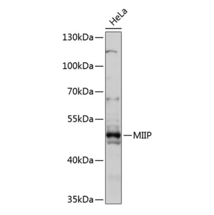 Western Blot - Anti-MIIP Antibody (A90139) - Antibodies.com