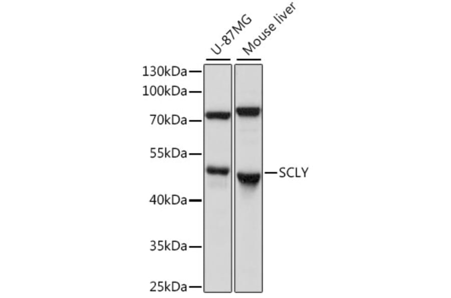 Western Blot - Anti-SCLY Antibody (A90140) - Antibodies.com