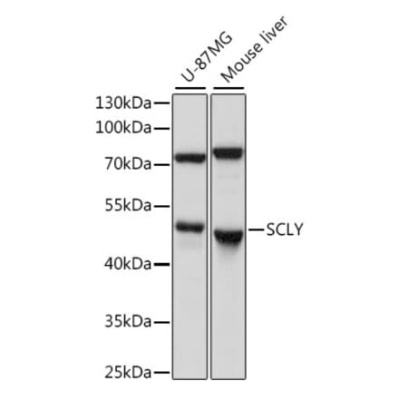 Western Blot - Anti-SCLY Antibody (A90140) - Antibodies.com
