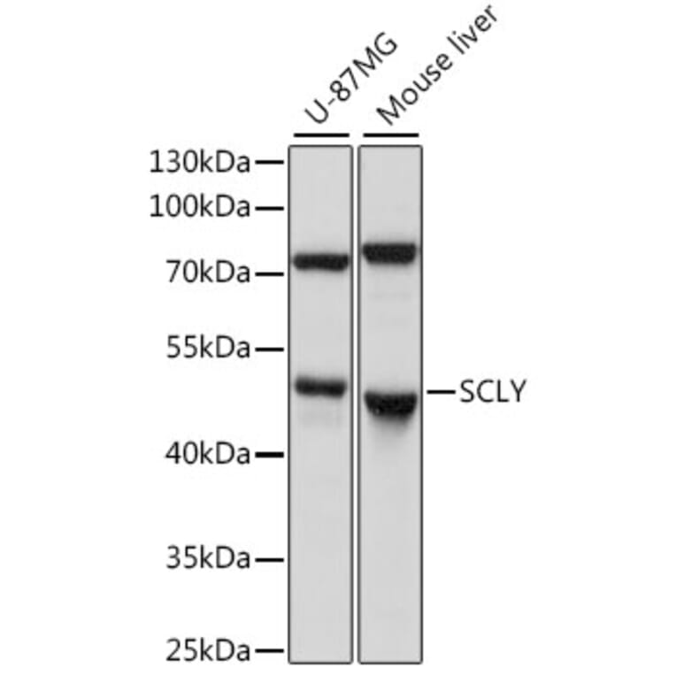 Western Blot - Anti-SCLY Antibody (A90140) - Antibodies.com