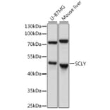 Western Blot - Anti-SCLY Antibody (A90140) - Antibodies.com