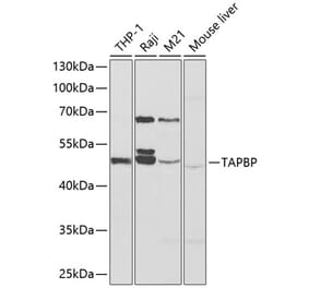 Western Blot - Anti-TPN Antibody (A90141) - Antibodies.com