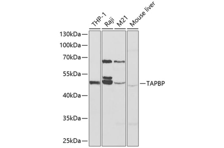 Western Blot - Anti-TPN Antibody (A90141) - Antibodies.com
