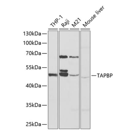 Western Blot - Anti-TPN Antibody (A90141) - Antibodies.com