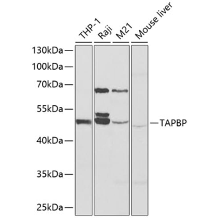 Western Blot - Anti-TPN Antibody (A90141) - Antibodies.com